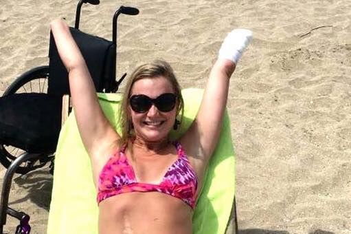 Jej zdjęcie w bikini poruszyło tysiące internautów. Historia Aimee Copeland