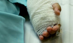 Dwulatek poparzył się ulicznymi halogenami. Ból i cierpienie wyceniono na 300 zł