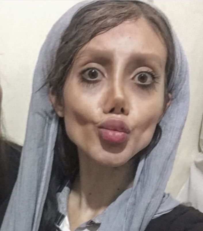 Chciała wyglądać jak Angelina Jolie – młoda Iranka zaszalała