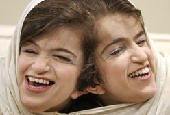 Operacja rozdzielenia bliźniaczek