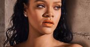 Rihanna uległa poważnemu wypadkowi. Zdjęcia posiniaczonej gwiazdy trafiły do sieci