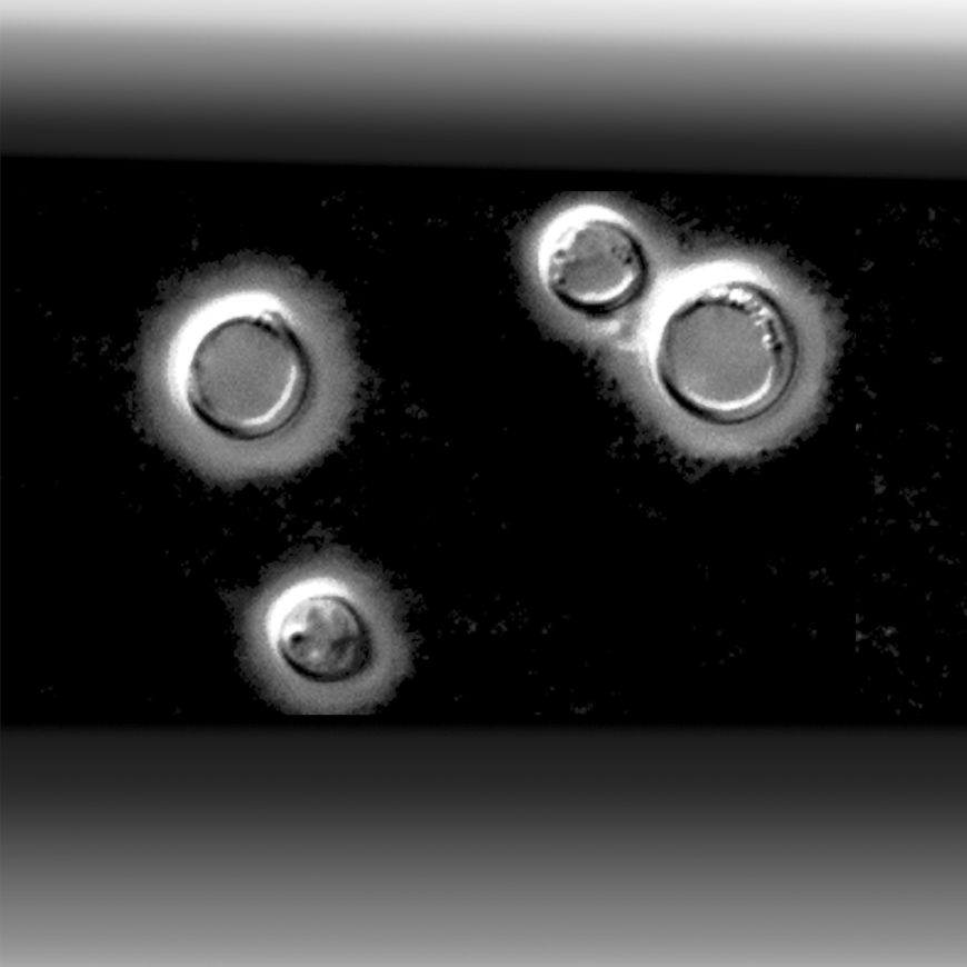 Zdjęcie bakterii wywołującej kryptokozę