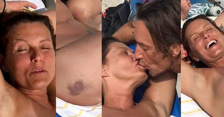 Prawie naga Ilona Felicjańska z ogromnym siniakiem na pupie zaklina rzeczywistość ustawką na florydzkiej plaży (ZDJĘCIA +18)