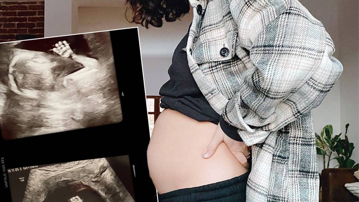 Marcelina Szostek jest w ciąży