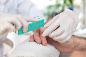 Łuszczyca paznokci – przyczyna, objawy i leczenie