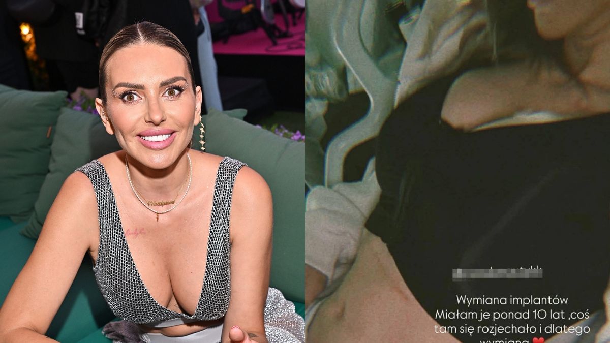 Monika Goździalska o operacji nosa i piersi