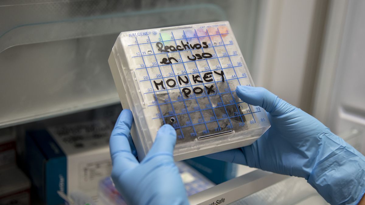 Próbki małpiej ospy