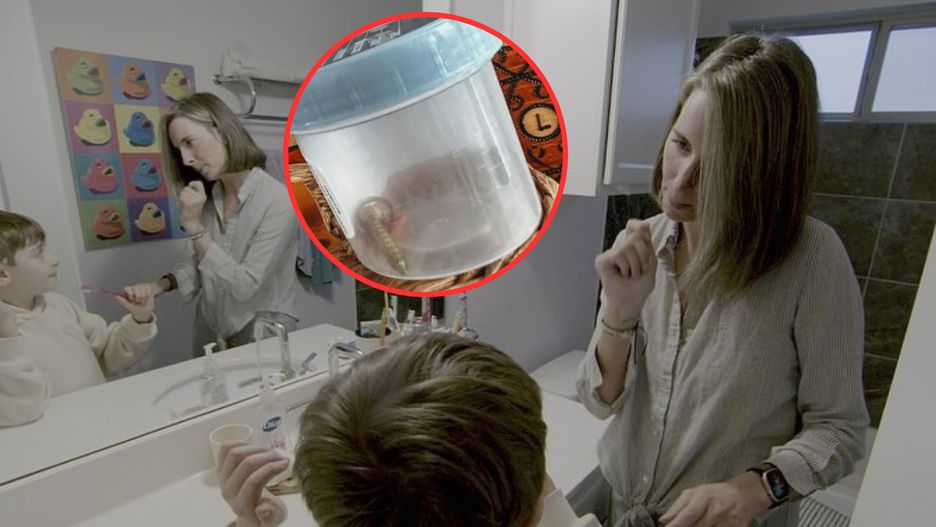 Badanie ujawniło śrubę w jelitach chłopca