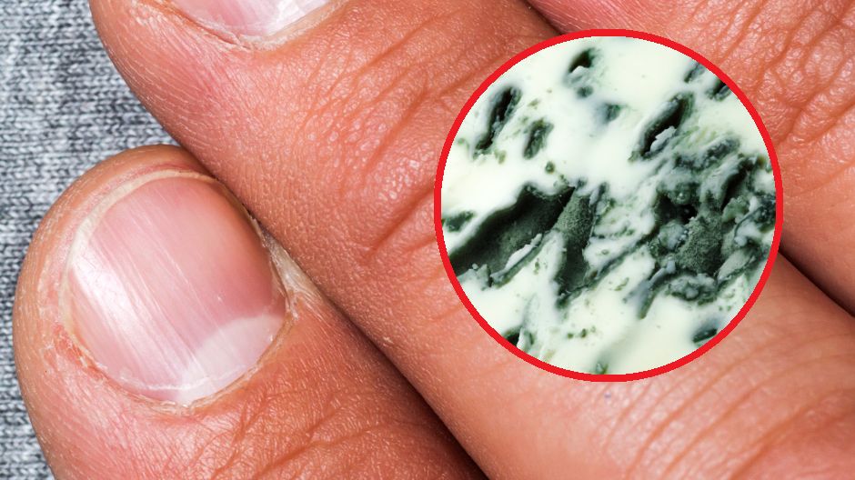 Wygląd paznokci może powiedzieć o kondycji naszego zdrowia znacznie więcej, niż przypuszczamy.