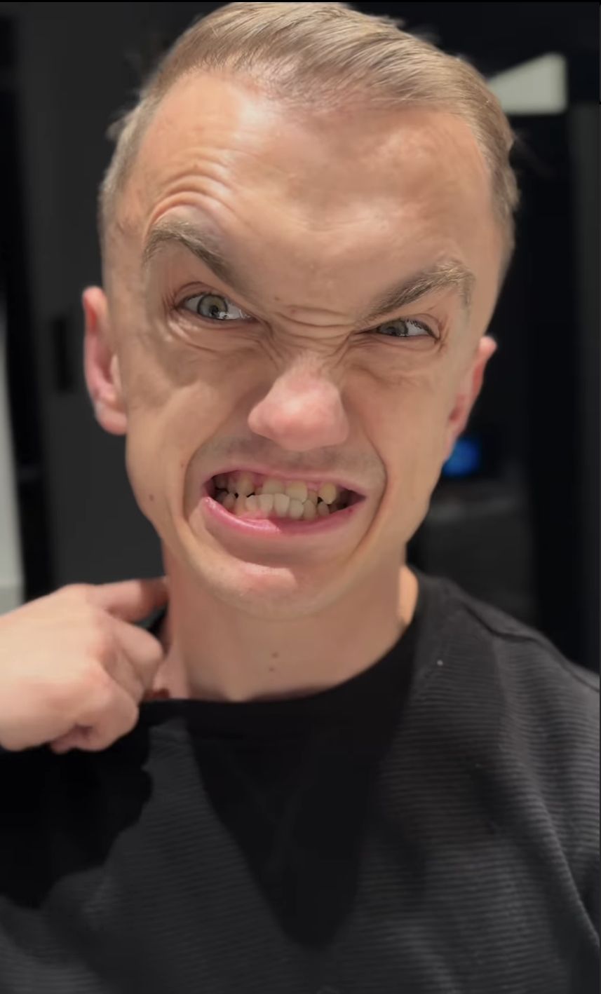 Mini Majk zaprezentował odmieniony uśmiech