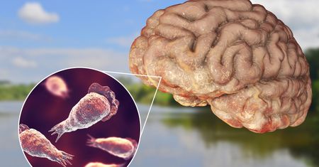 Naegleria fowleri atakuje. Grasuje w ciepłych kąpieliskach