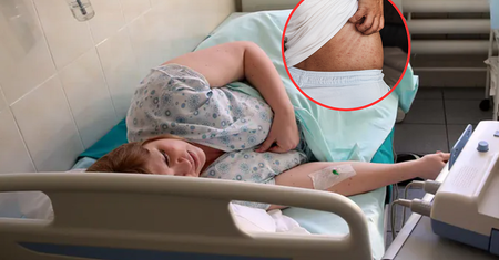 Zachoruje co trzecia osoba po ospie. Wirus może uaktywnić się po latach