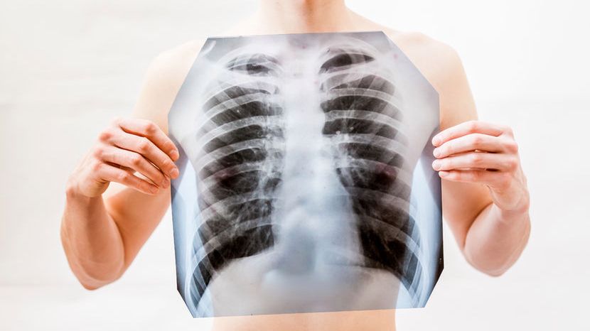 Zioła naturalnie oczyszczają płuca z zanieczyszczeń