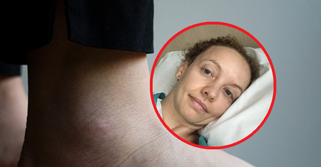 Przeszła dwa zawały serca w ciągu dwóch lat. Ostrzega przed nietypowymi objawami