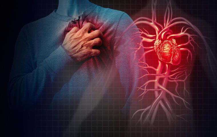 Zespół Dresslera występuje u 0,5-4,5% pacjentów w 2-10 tygodniu po zawale mięśnia sercowego