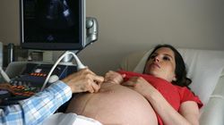 Legalnych aborcji przybywa. Mają związek ze wskazaniami psychiatrycznymi