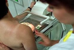 Pracujące kobiety będą musiały wykonywać cytologię i mammografię