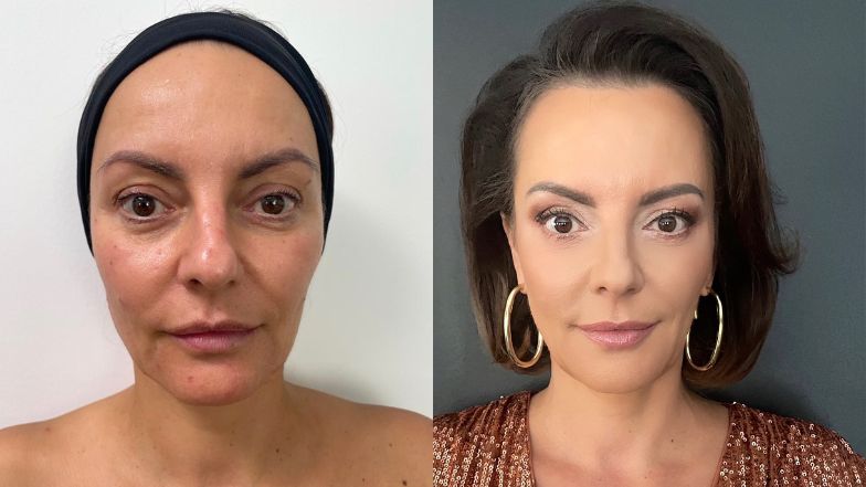 "Młodość na zamówienie". Jak zmieniły się bohaterki nowego programu o metamorfozach?