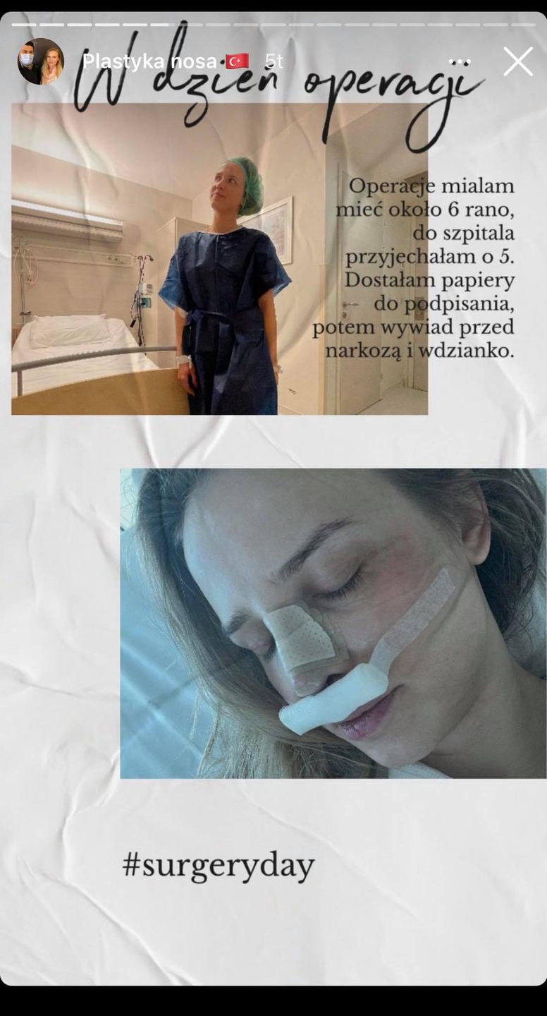 operacja plastyczna