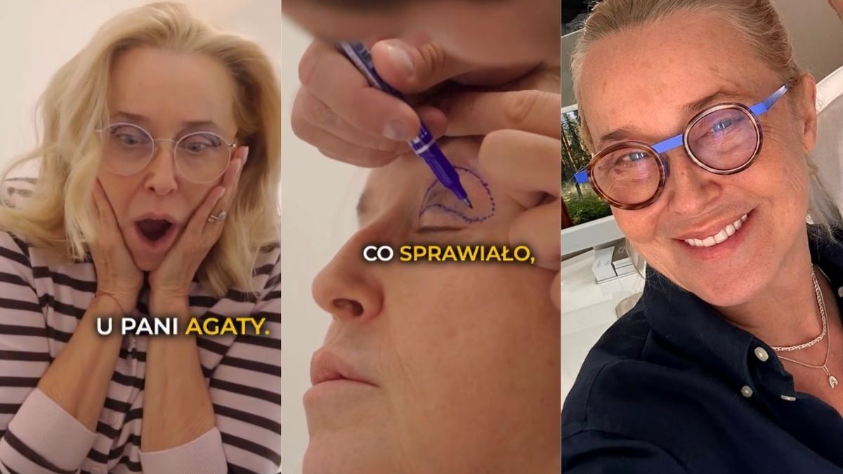Agata Młynarska "zrobiła" powieki
