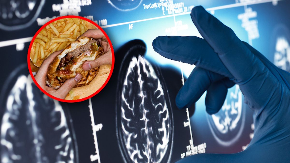 Dieta bogata w tłuszcze i cukry upośledza pamięć przestrzenną. Jak temu przeciwdziałać?