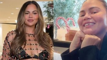 Świąteczny DRAMAT Chrissy Teigen: STRACIŁA ZĘBA! Poległ w starciu ze świątecznym cukierkiem... (FOTO)