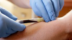 BASO morfologia - na czym polega i na co wskazuje badanie?