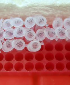 Koronawirus. Kiedy szczepionka? Niemiecka minister o przyspieszeniu prac