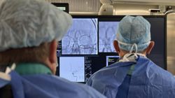 Więcej operacji i szybsza pomoc. Przełom w leczeniu udarów mózgu na Mazowszu