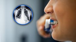 Nie myjesz zębów? Narażasz się na zapalenie płuc