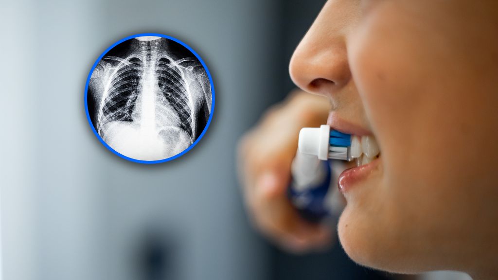 Im gorszy stan jamy ustnej, tym wyższe ryzyko infekcji dolnych dróg oddechowych