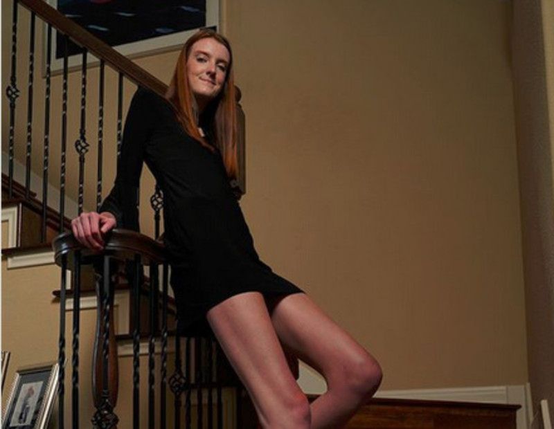 Ta 17-latka właśnie trafiła do Księgi Rekordów Guinessa. Ma najdłuższe nogi na świecie. Ile mierzą?