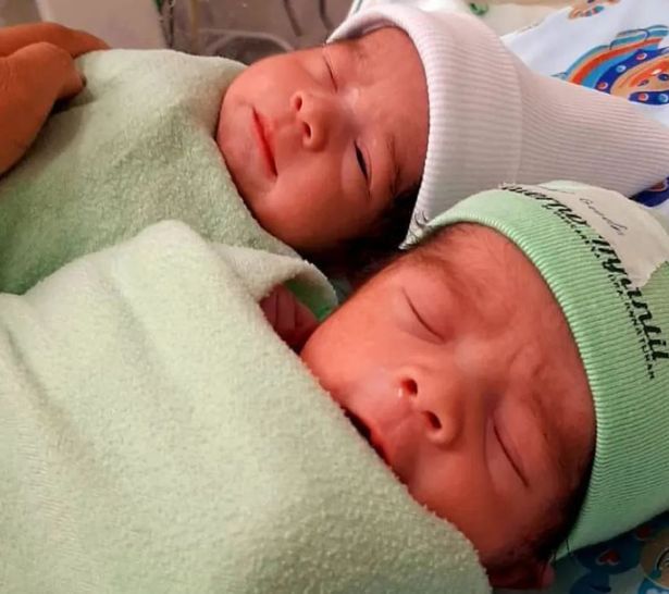 Bliźniaczki czują się dobrze