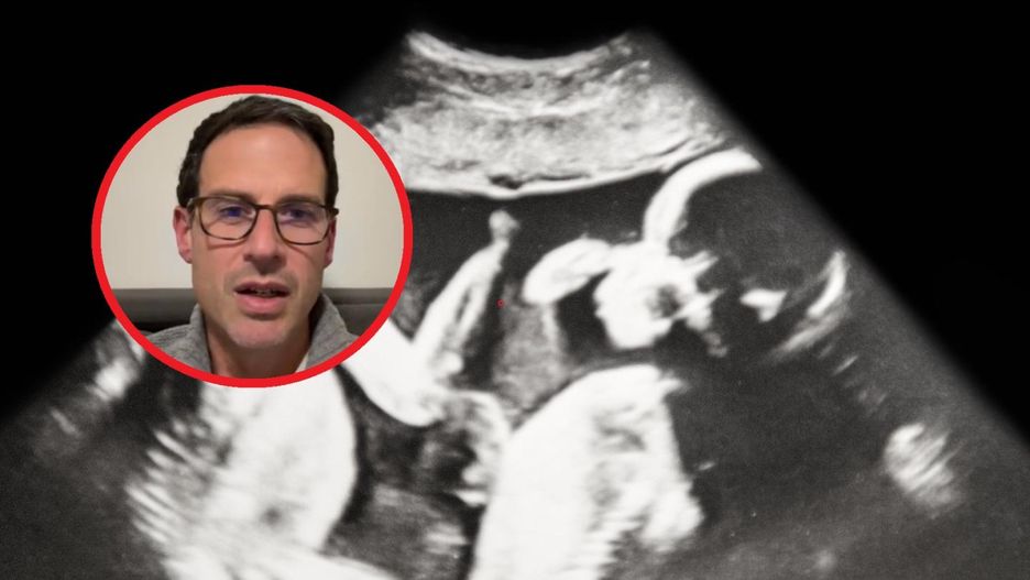 Tak od środka wyglądają ruchy dziecka w brzuchu. Lekarz pokazał zachwycający filmik