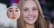 Była dziecięcą gwiazdą, uzależnienia zniszczyły jej karierę. Amanda Bynes nie przypomina dawnej siebie [ZDJĘCIA]