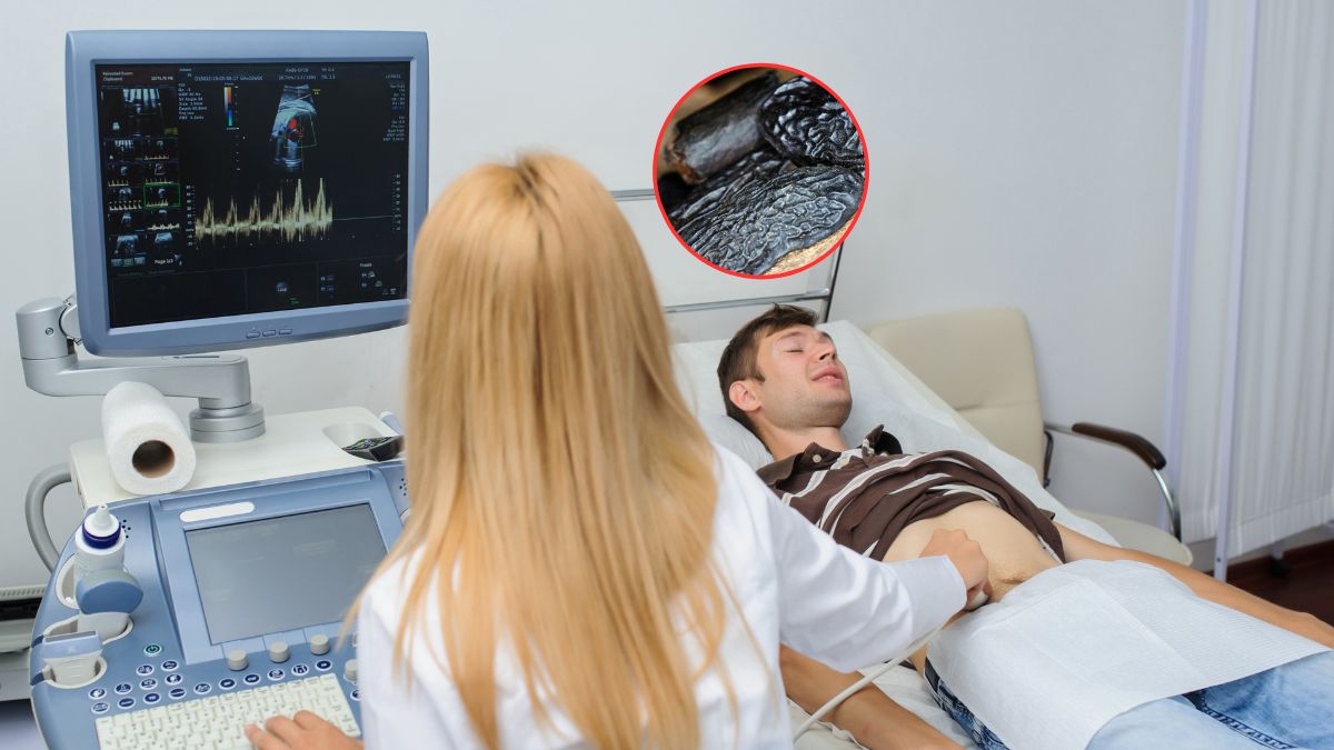 Fasola tonka zawiera szkodliwie działającą kumarynę