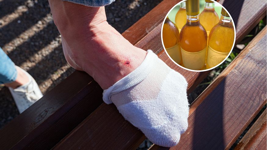 Uporczywe swędzenie skóry bez wyraźnego powodu? To może być objaw niebezpiecznej choroby