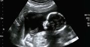 "Dziecko płacze w macicy?". Naukowcy rozwiązali zagadkę