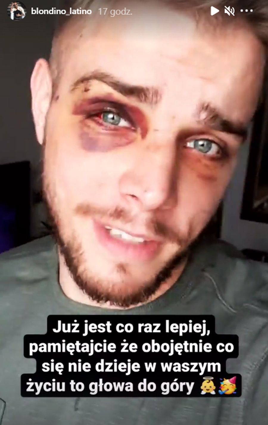 Blondino z "Hotelu Paradise" został pobity i okradziony