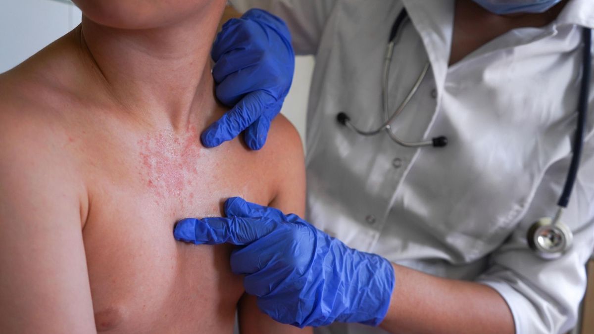 Zakażenia grzybicze stanowią poważne zagrożenie dla zdrowia