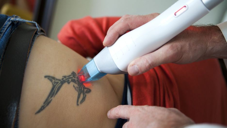 Usuwanie tatuażu za pomocą lasera czyli laseroterapia uważana jest za najskuteczniejszą metodę wykorzystywaną do usunięcia wzoru ze skóry. 
