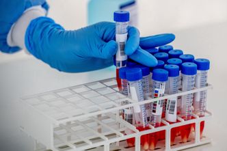 Koronawirus w Polsce. Niemal 600 nowych przypadków zakażeń