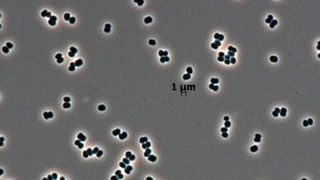 Bakteria Tersicoccus phoenicis 