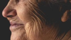 Składniki, które działają jak naturalny botoks. Wygładzają zmarszczki od środka