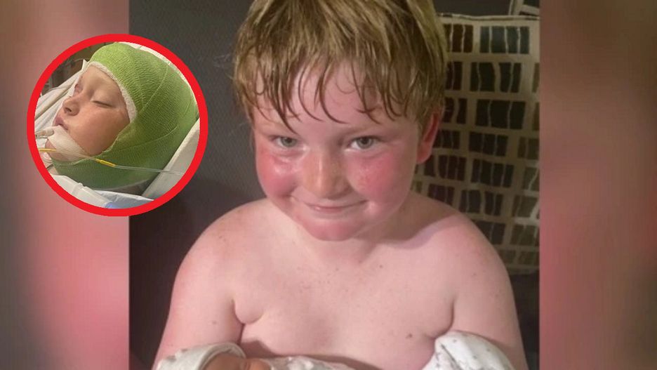 W USA psy dotkliwie pogryzły 11-latka. Chłopiec walczy o życie w szpitalu