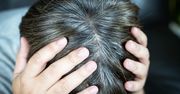 Masz siwe kosmyki? To może być objaw choroby nazywanej cichym zabójcą