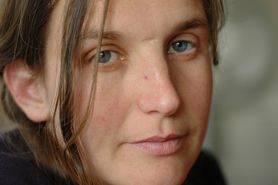 Nerwica natręctw - rodzaje, przyczyny, objawy, leczenie