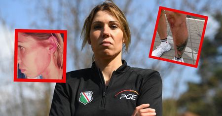 Klepacka: Zostałam pobita przed Muzeum Powstania Warszawskiego