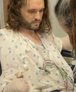 Ugryzła pchła. Lekarze musieli amputować ręce mężczyźnie