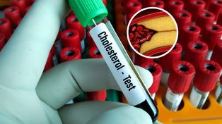 Wypłukuje cholesterol z tętnic. "Ostatnia deska ratunku"